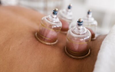 Myofascial Cupping